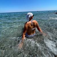 alopeciaa_girl