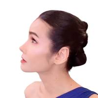 mild_5324
